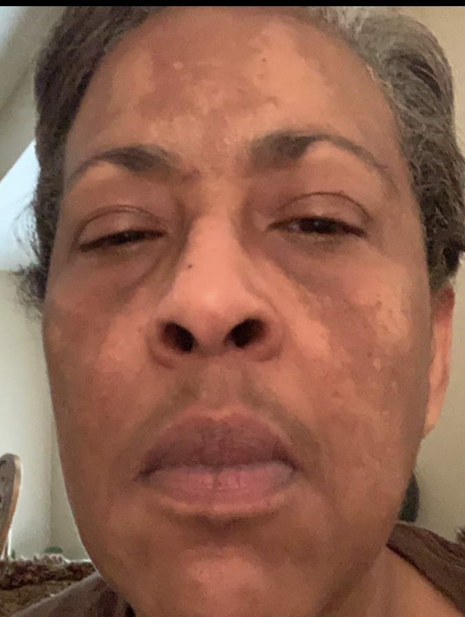 The Spot Cream review photo by Sandra T.