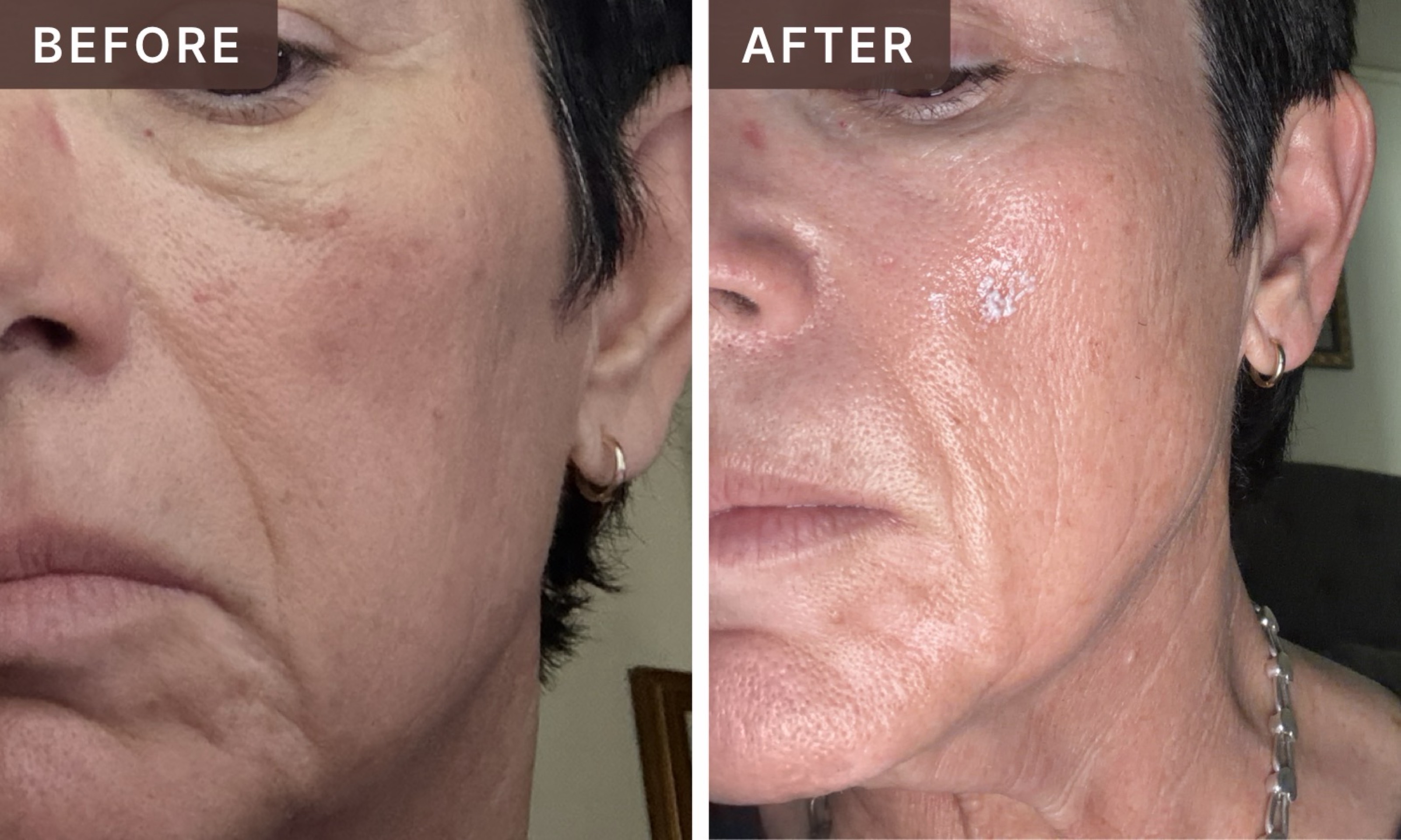 Ana M. -- before and after, 8 weeks