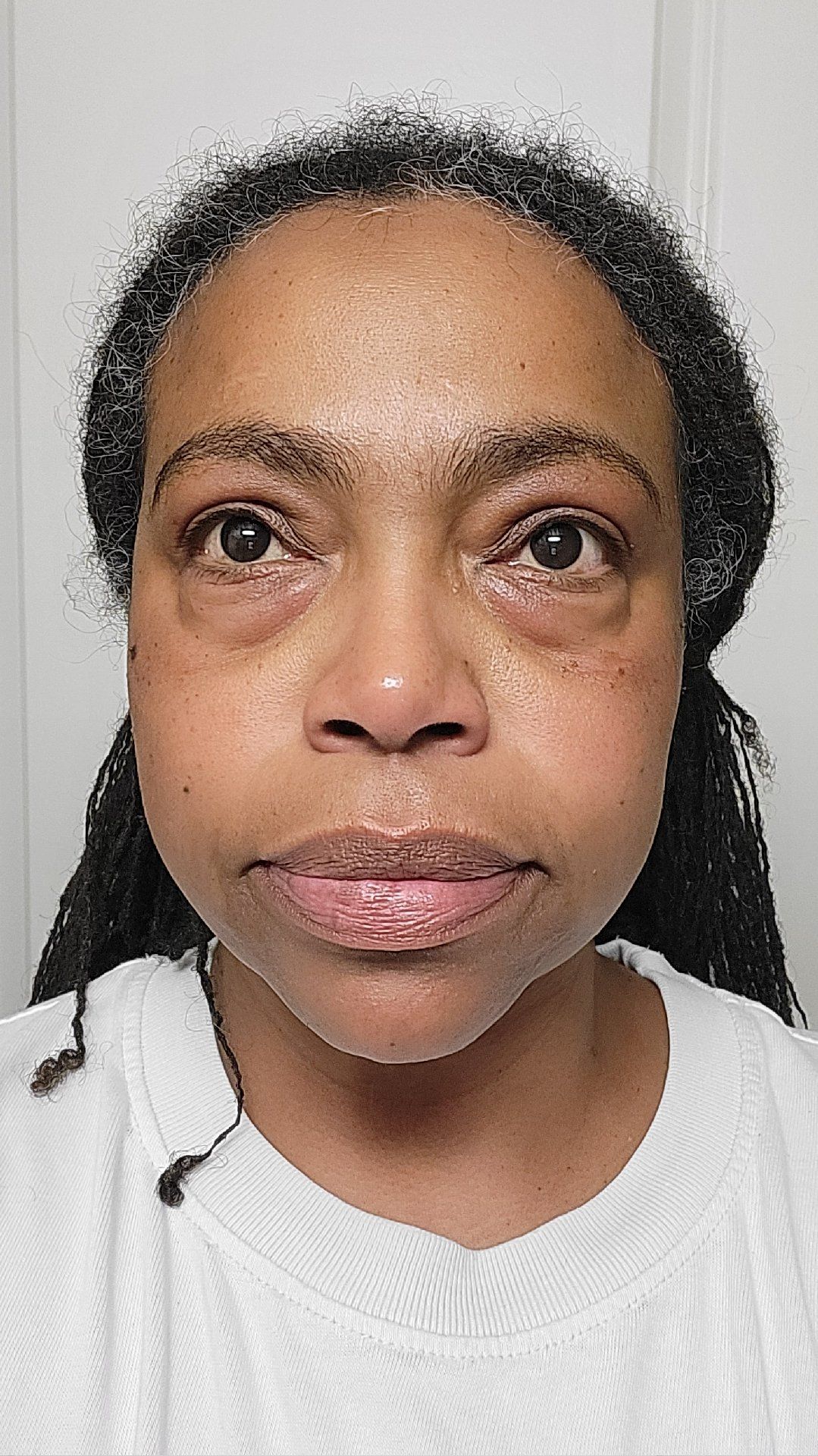 Post attachment 3