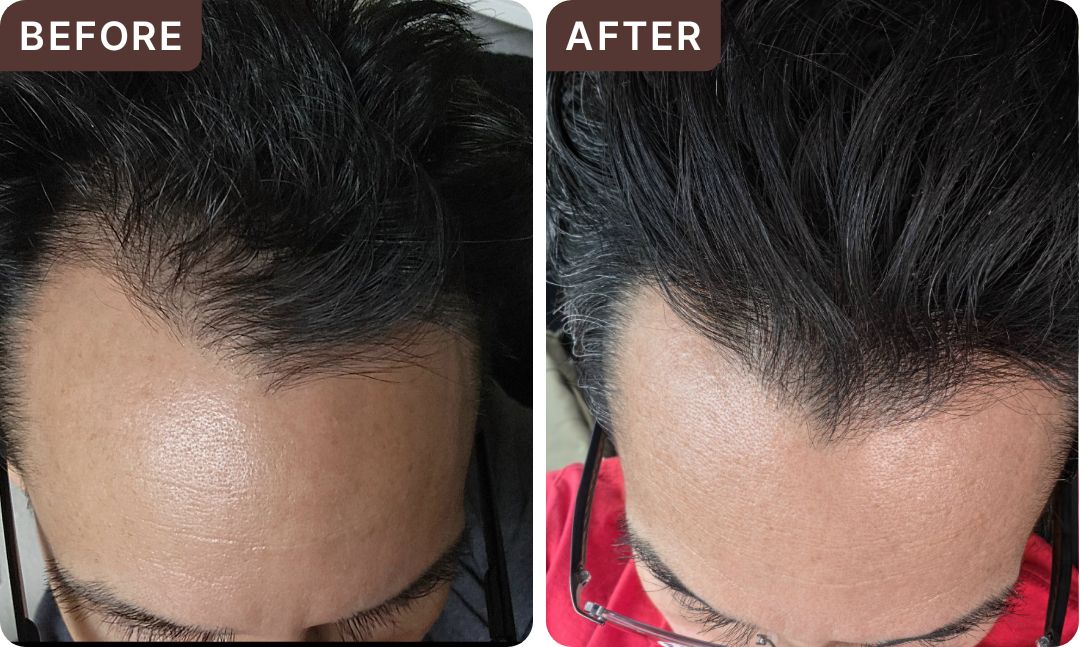 Stefan M. -- before and after, 8 weeks