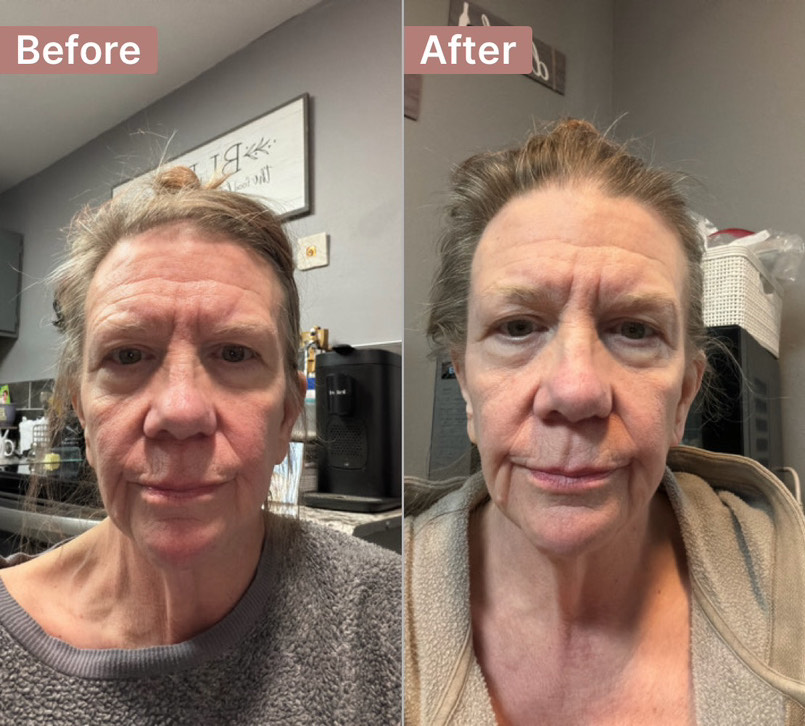 The Anti-Aging Cream review photo by Cheryl M.