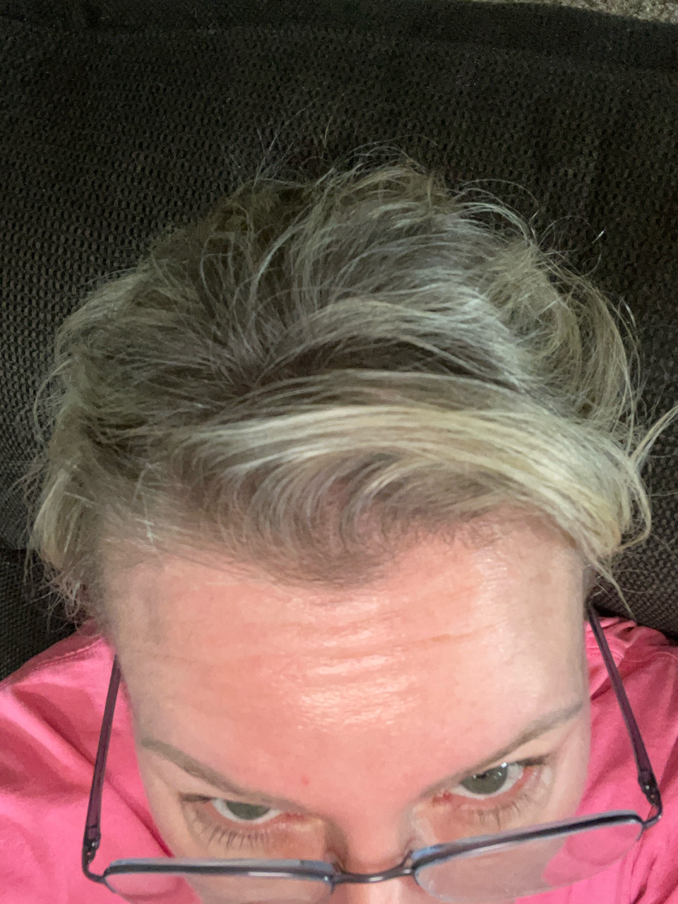 The Hair Pill review photo by Amber H.