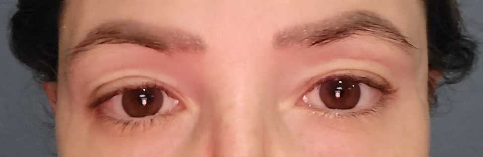 The Lash Serum review photo by Angela H.