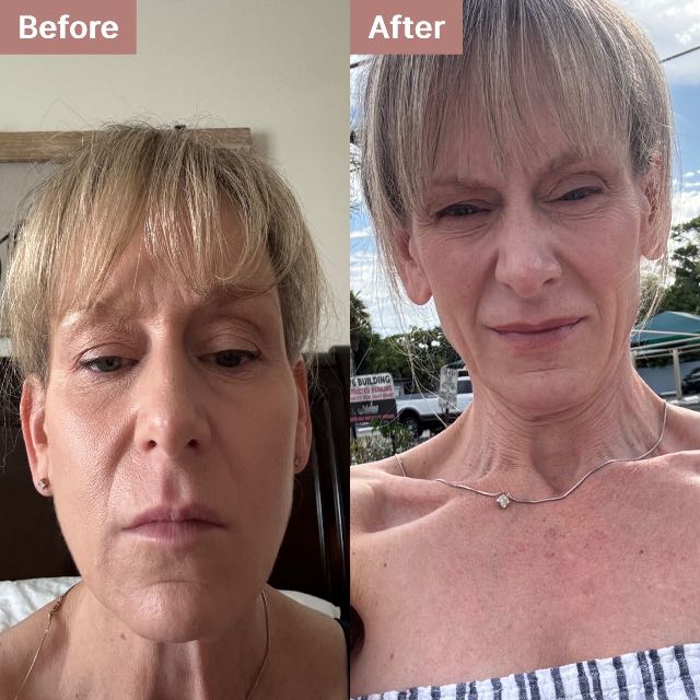 Jennifer's story