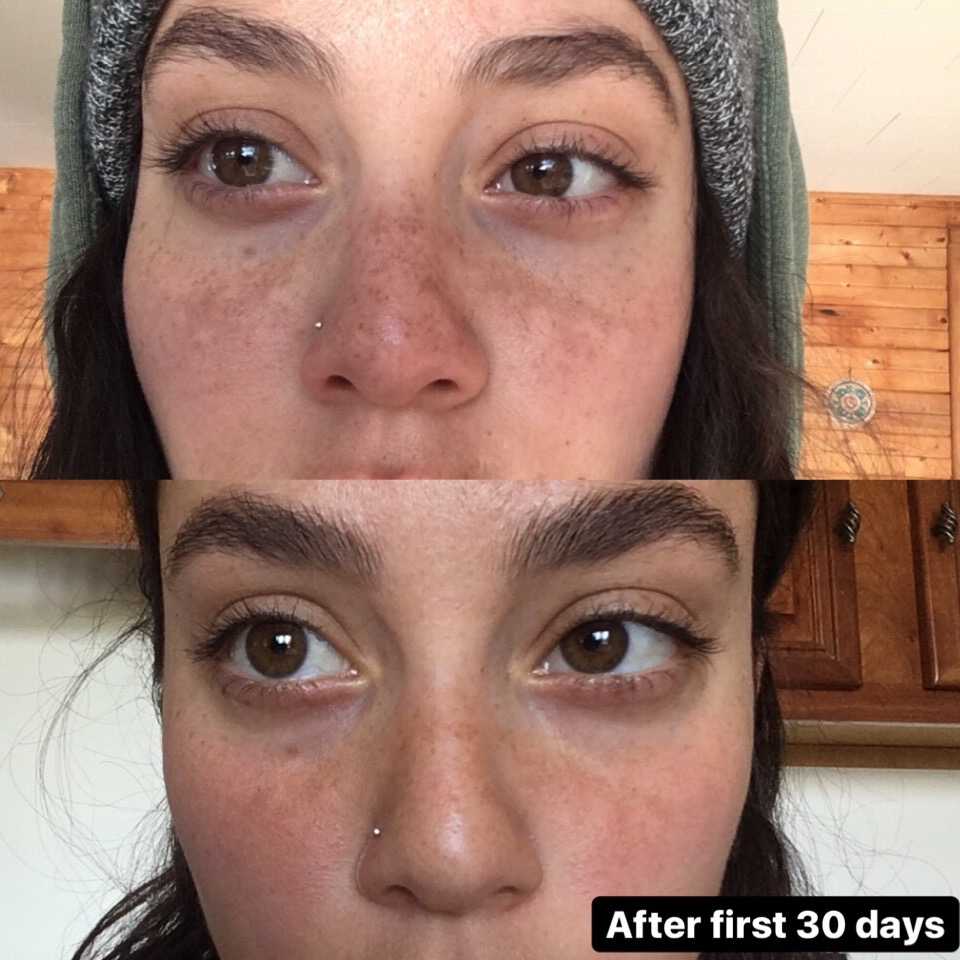 The Spot Cream review photo by Mara S.