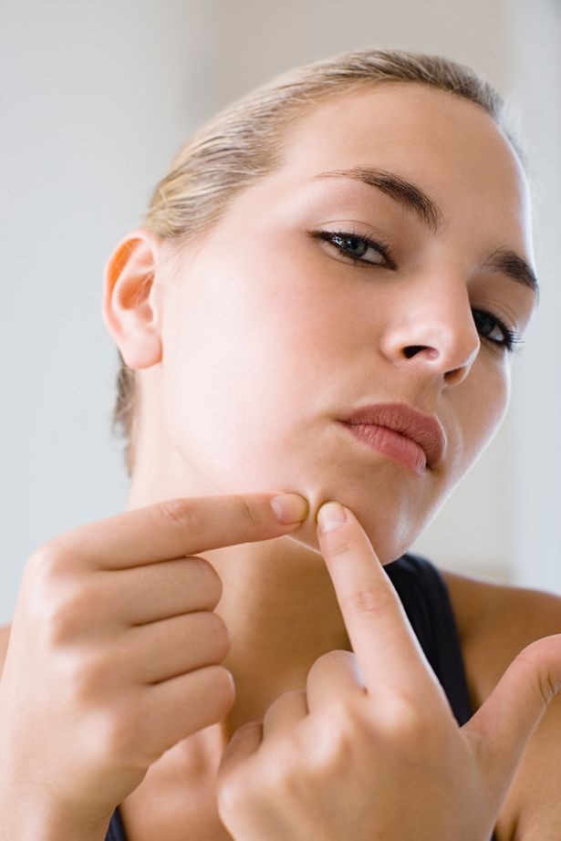 How To Get Rid Of BAD Acne!! REALLY WORKS!!!!! Musely