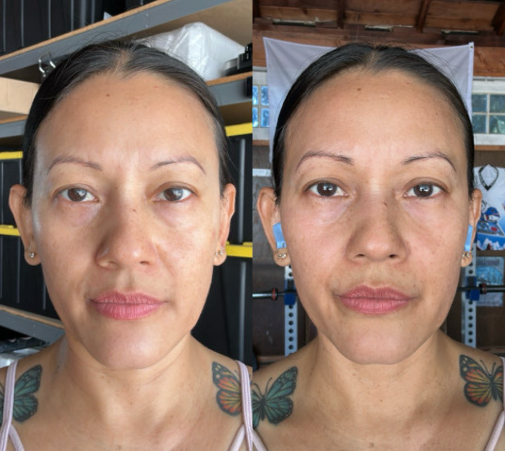 Customer photo