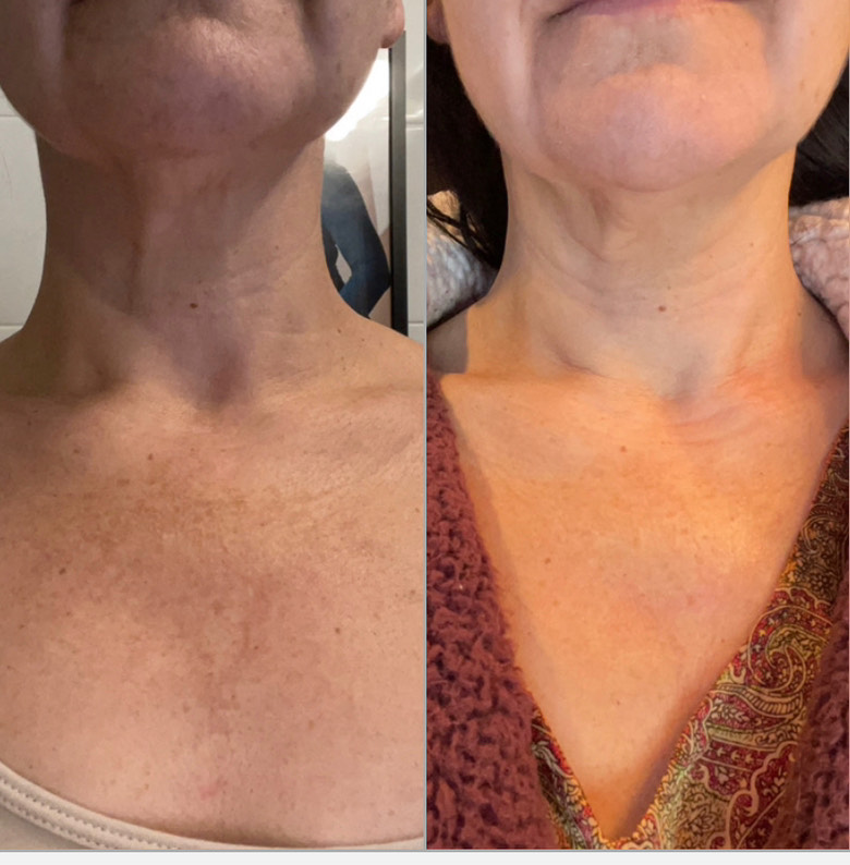 Customer photo