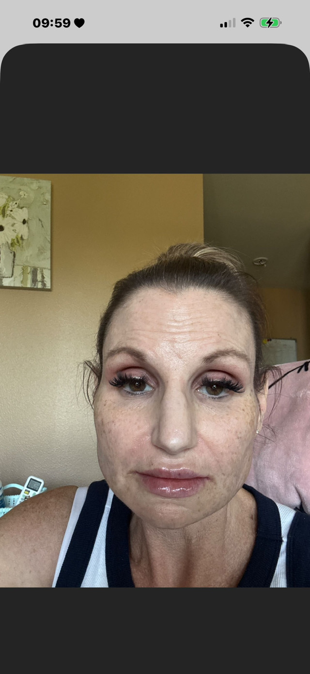 Post attachment 3