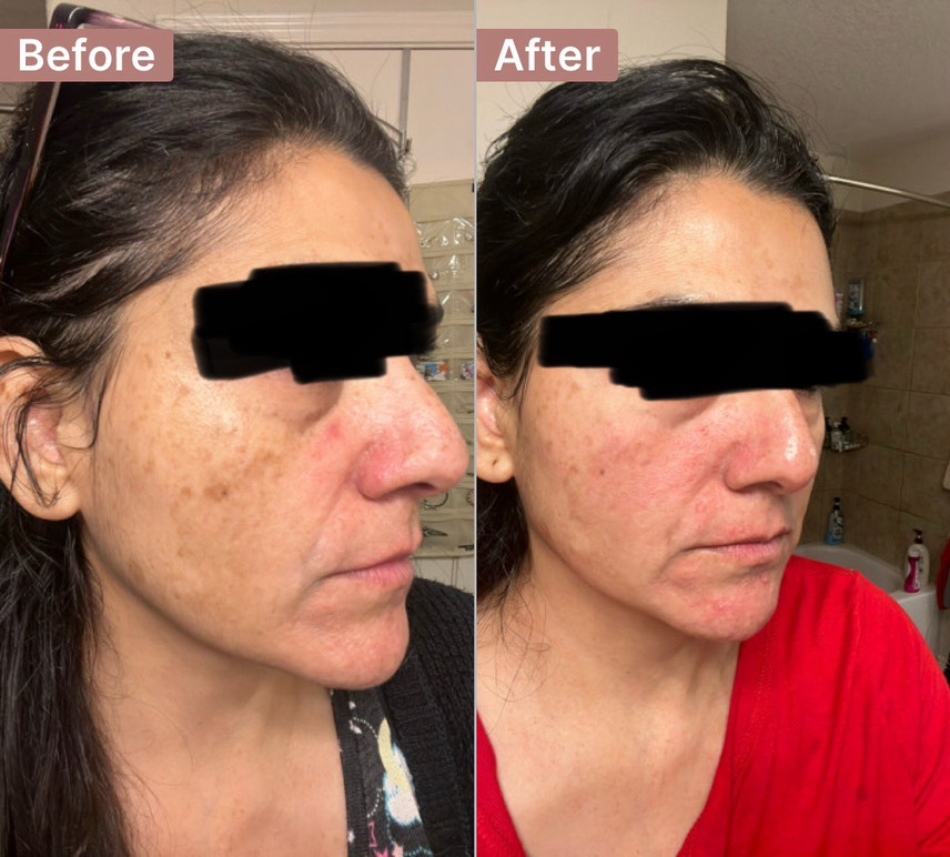 The Spot Cream review photo by Siboney B.