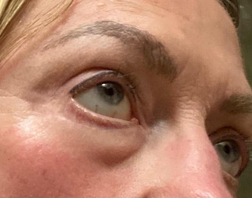 The Eye Serum review photo by Rebecca M.