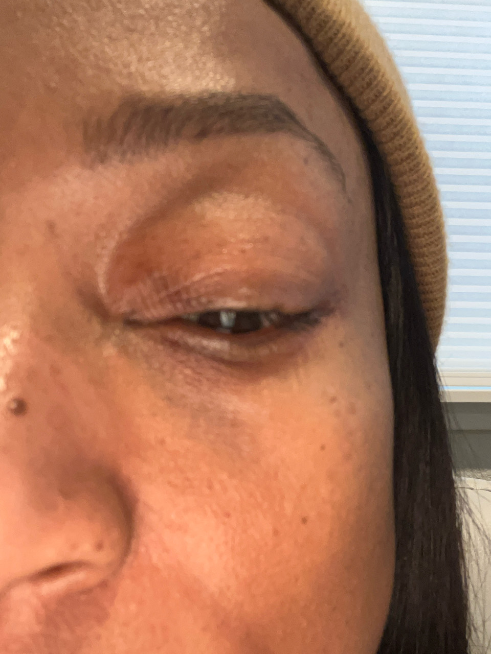 The Eye Serum review photo by Tonya L.