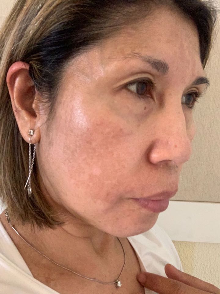 The Spot Cream review photo by Dolores A.