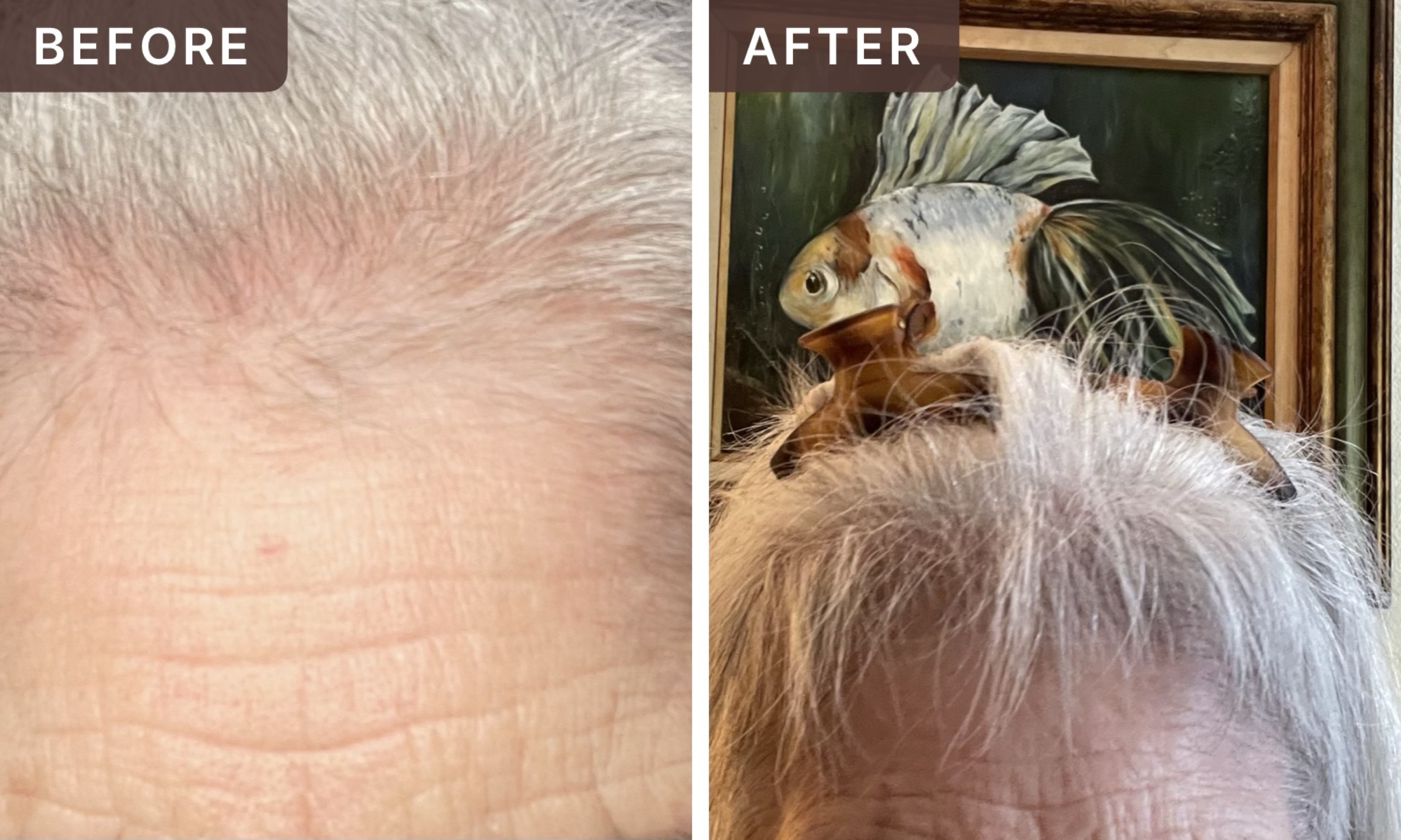 Mary S. -- before and after, 8 weeks
