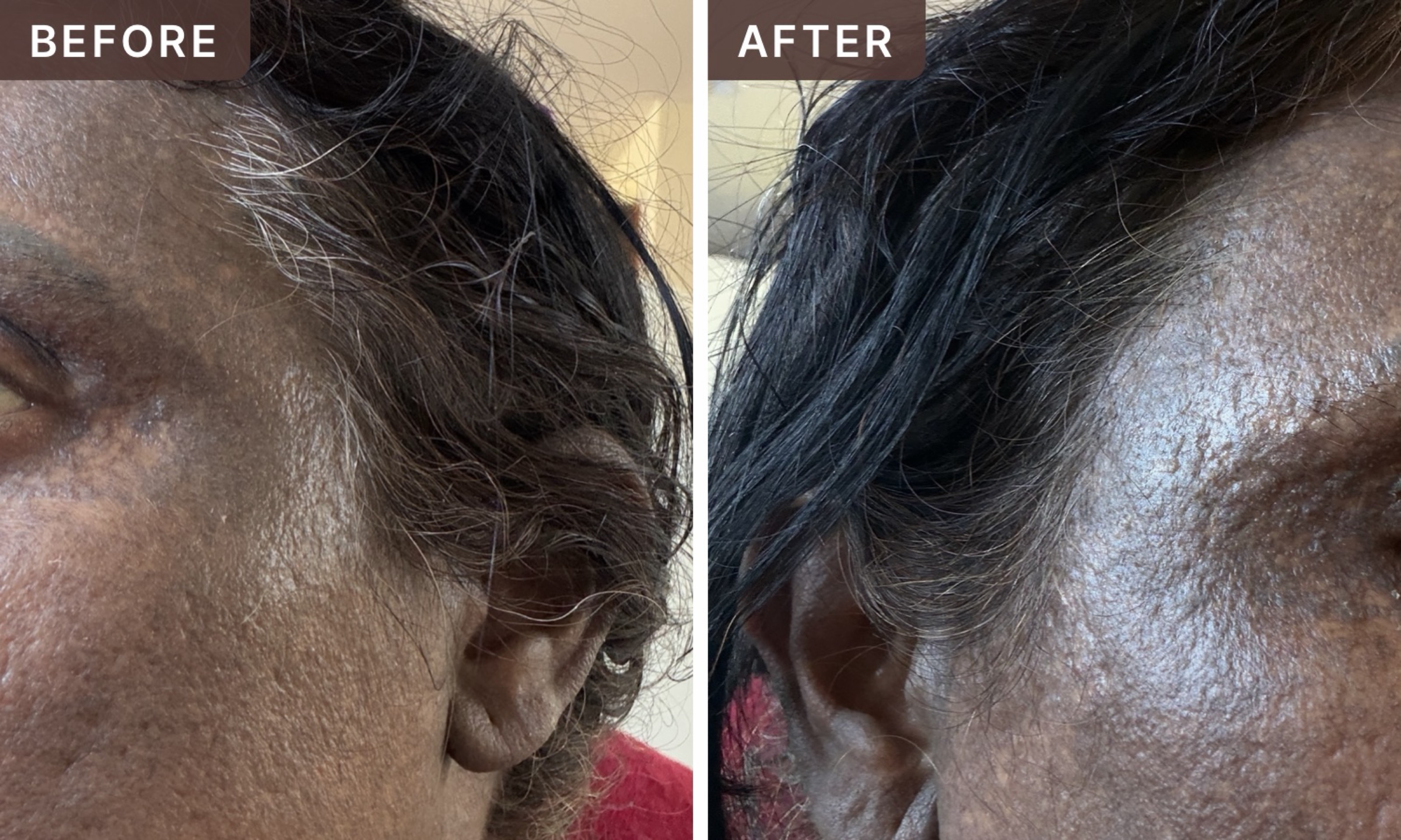 Neelima A. -- before and after, 8 weeks
