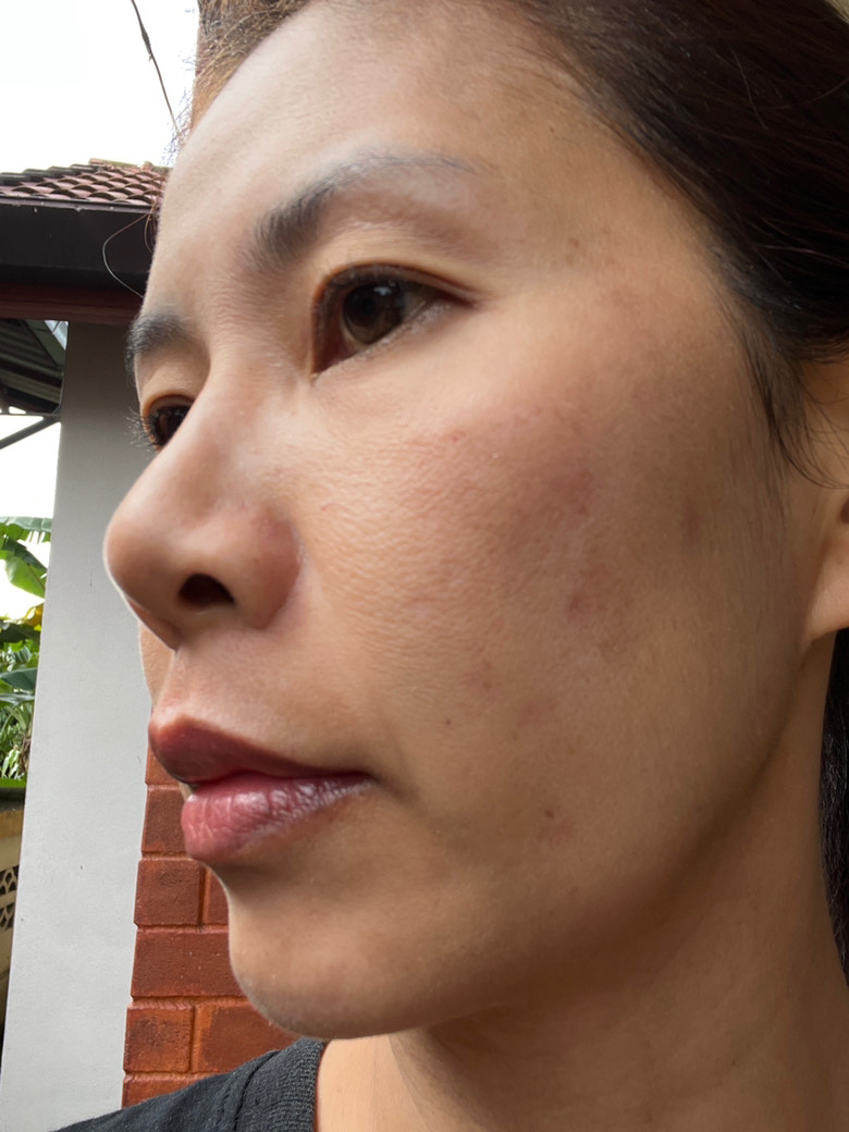 The Spot Cream review photo by Natthacha  B.