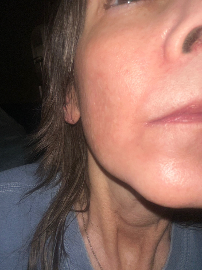 Customer photo