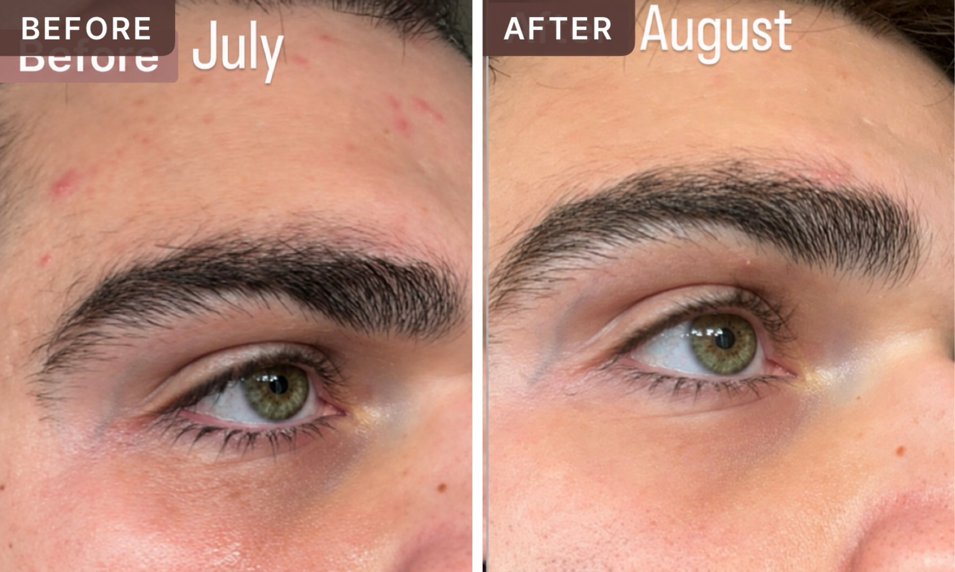 Elijah C. -- before and after, 8 weeks