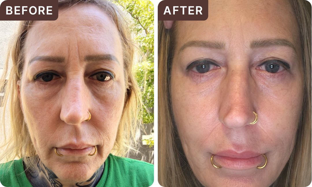 Lindsay G. -- before and after, 3 weeks
