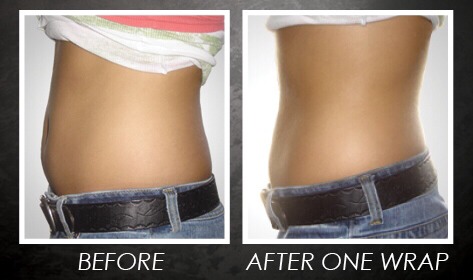 Hcg weight loss dallas tx image 10