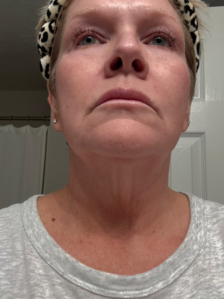 Customer photo