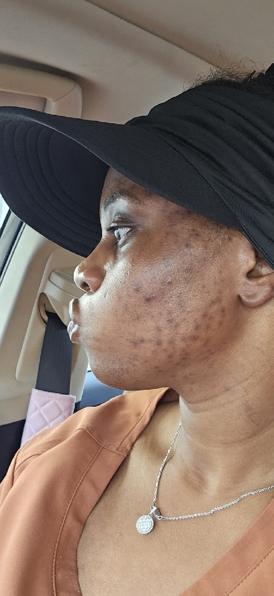 The Spot Cream review photo by Guerline J.