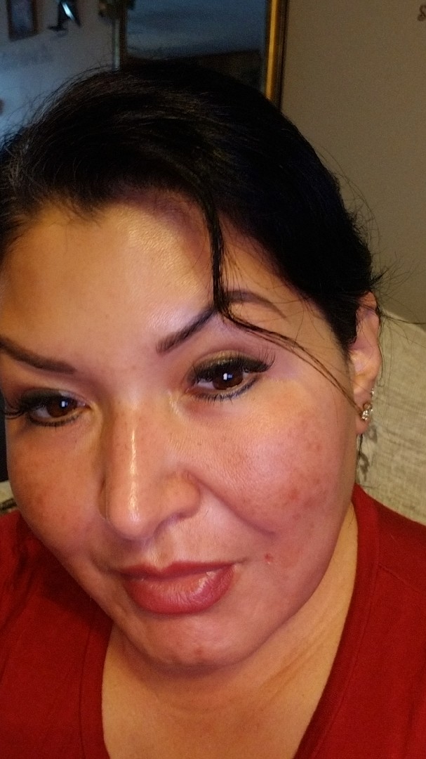 The Spot Cream review photo by Janeth Z.