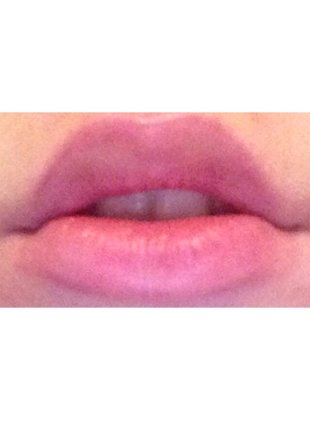 how-to-get-big-plump-lips-musely
