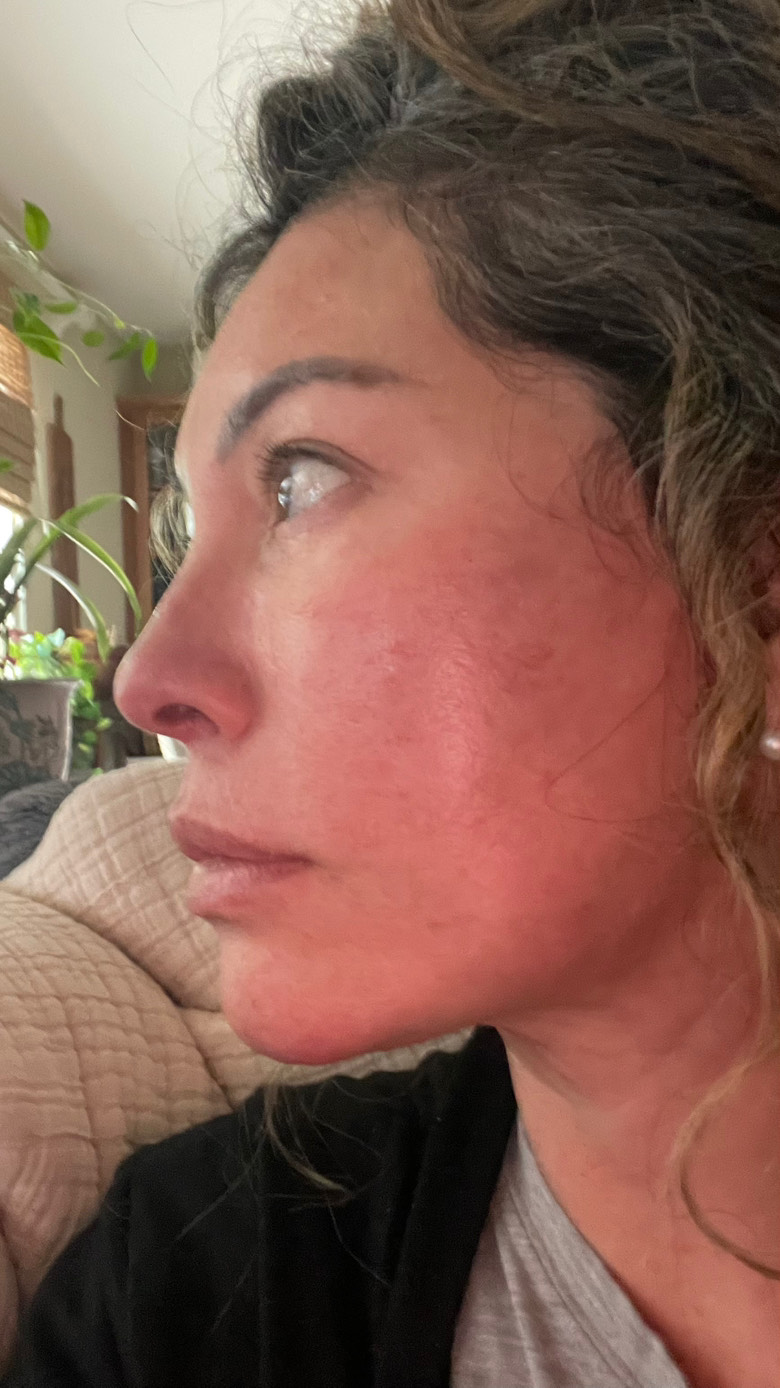 The Spot Cream review photo by Gina C.