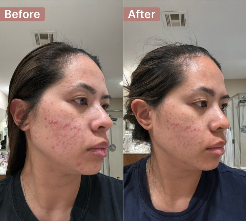 The Spot Cream review photo by Alexandra Z.