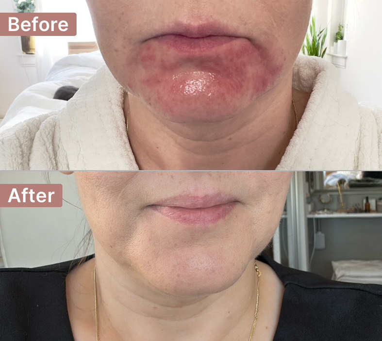 Customer photo