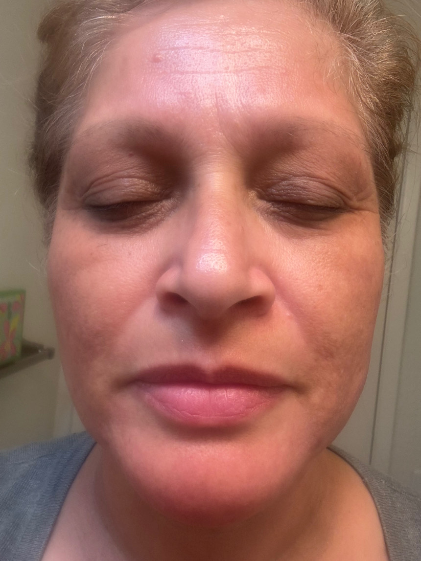 The Spot Cream review photo by Rose S.