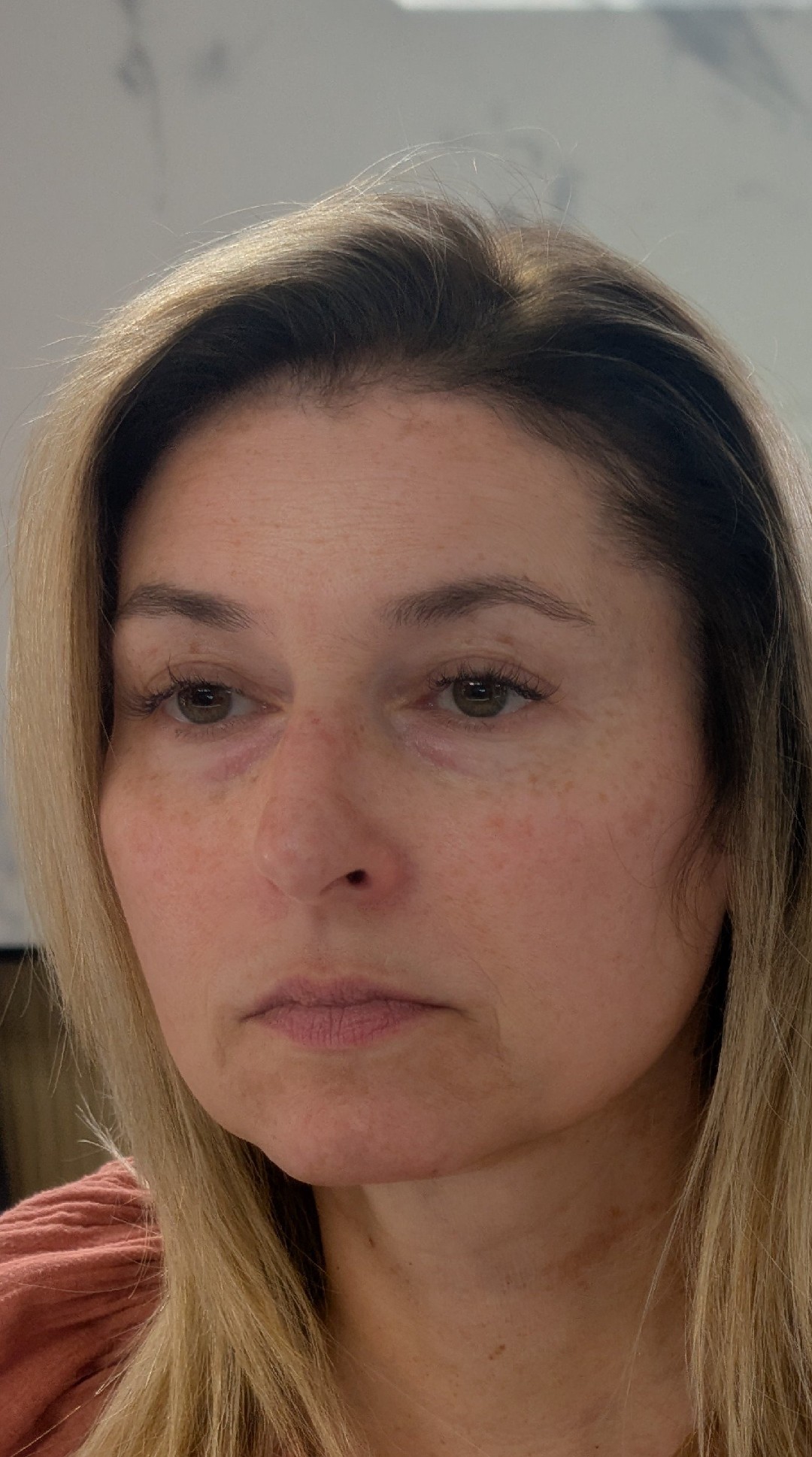 Before and after review photo
