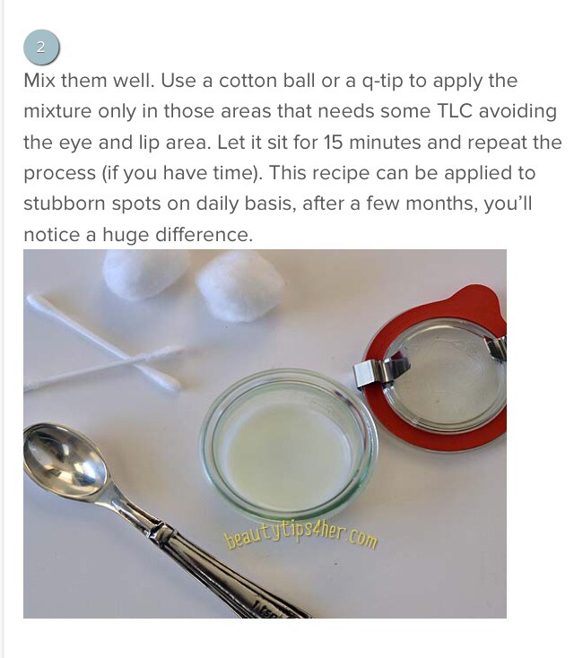 Spot Remover Age Spots & Dark Blemishes👌 Musely