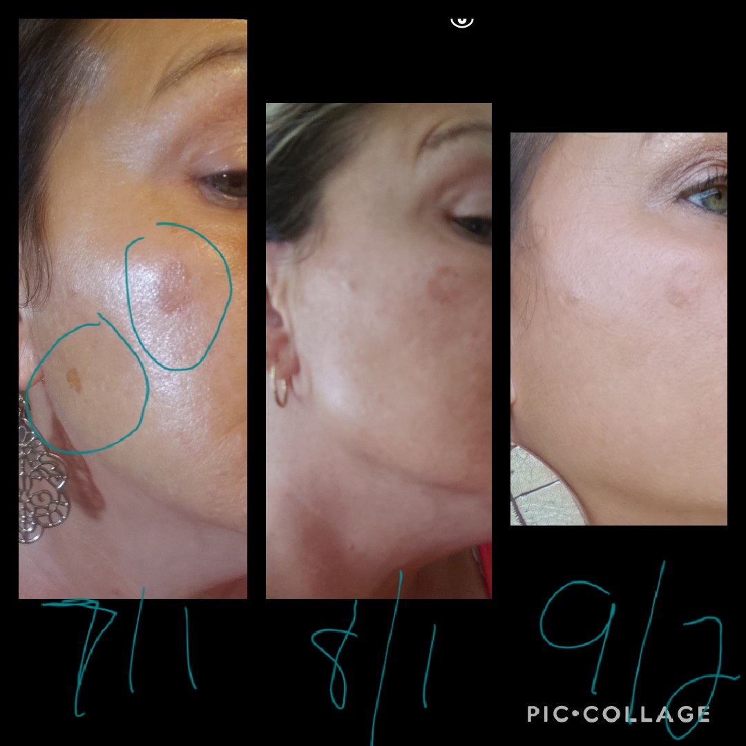The Spot Cream review photo by Natasha D.