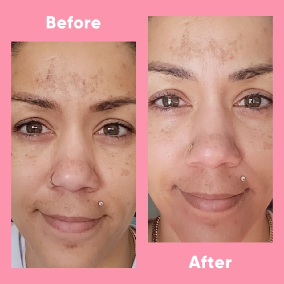 Customer photo