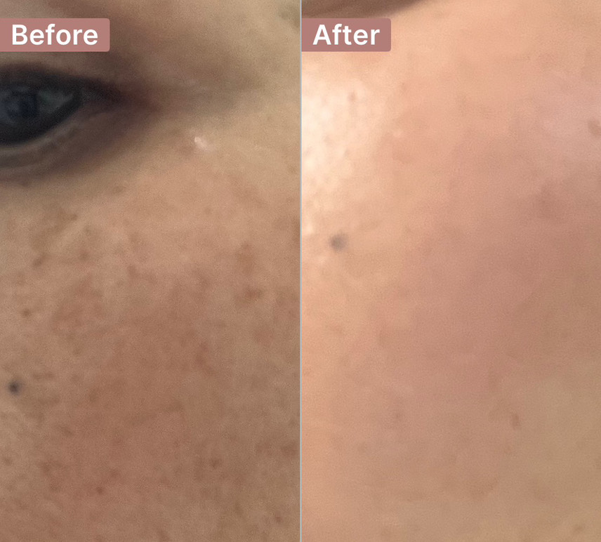 The Spot Cream review photo by Christie  V.