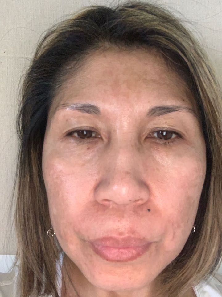 The Spot Cream review photo by Dolores A.