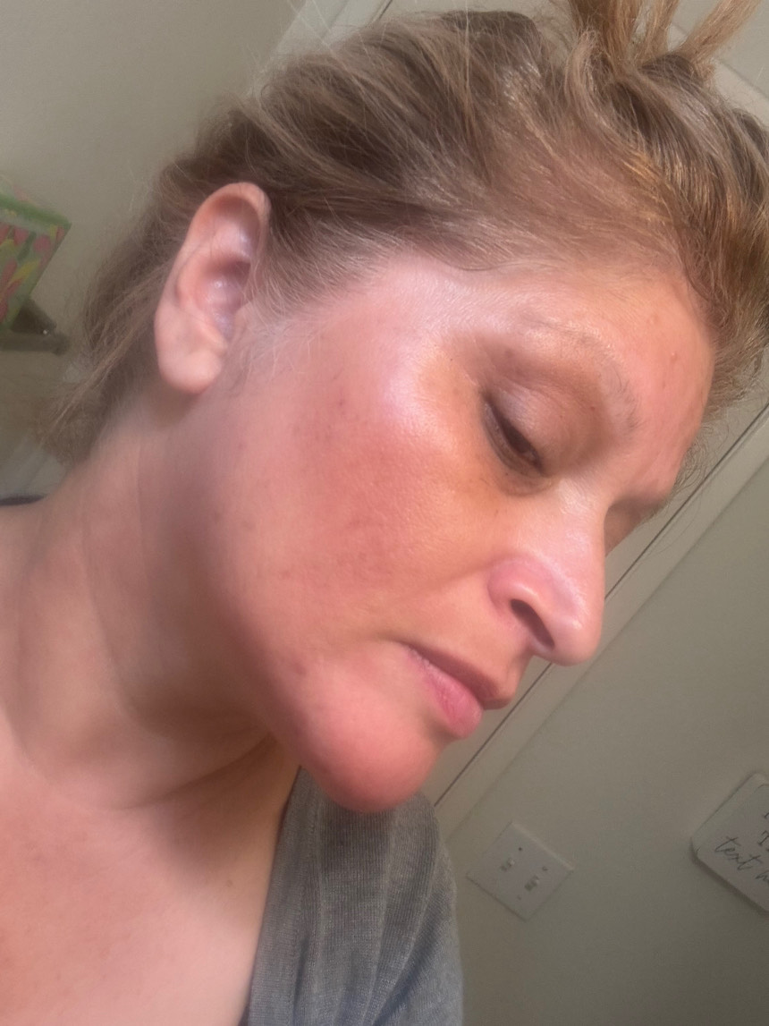 The Spot Cream review photo by Rose S.