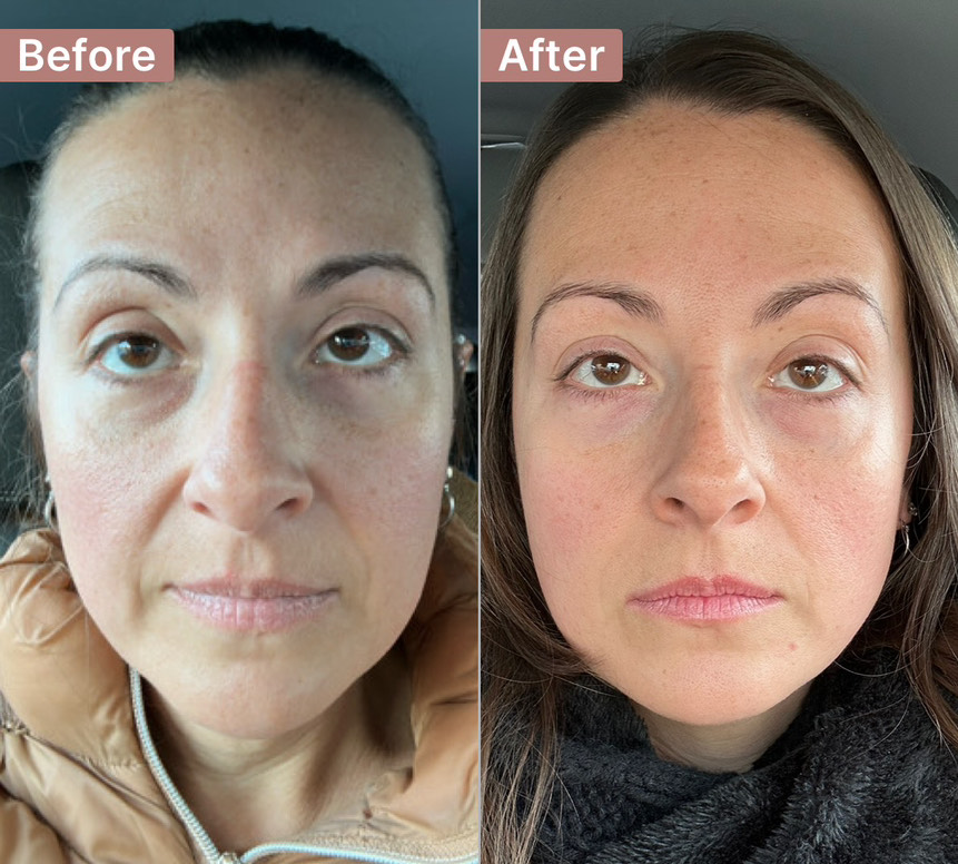 The Aging Repair Cream review photo by Angela M.K K.