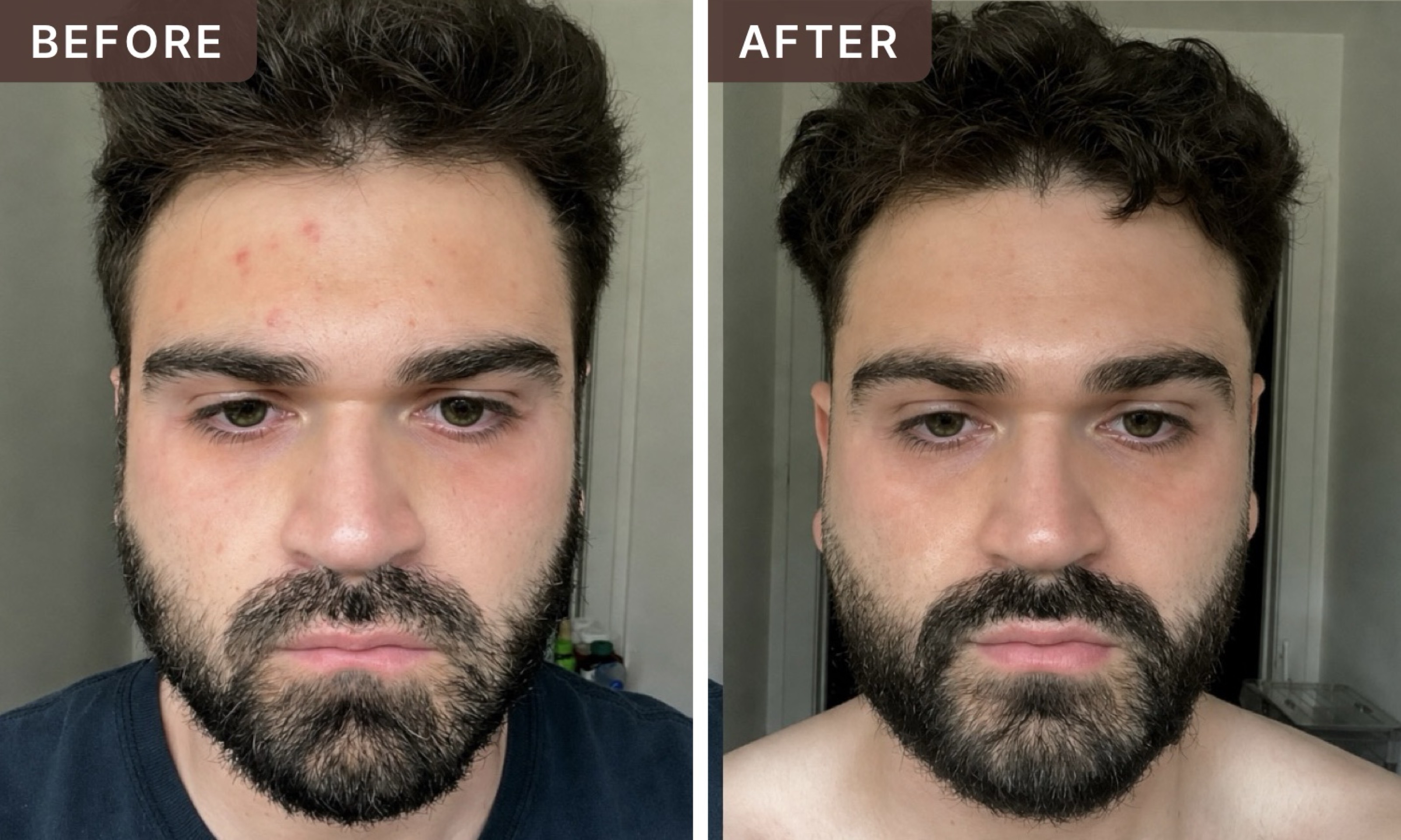 Elijah C. -- before and after, 8 weeks