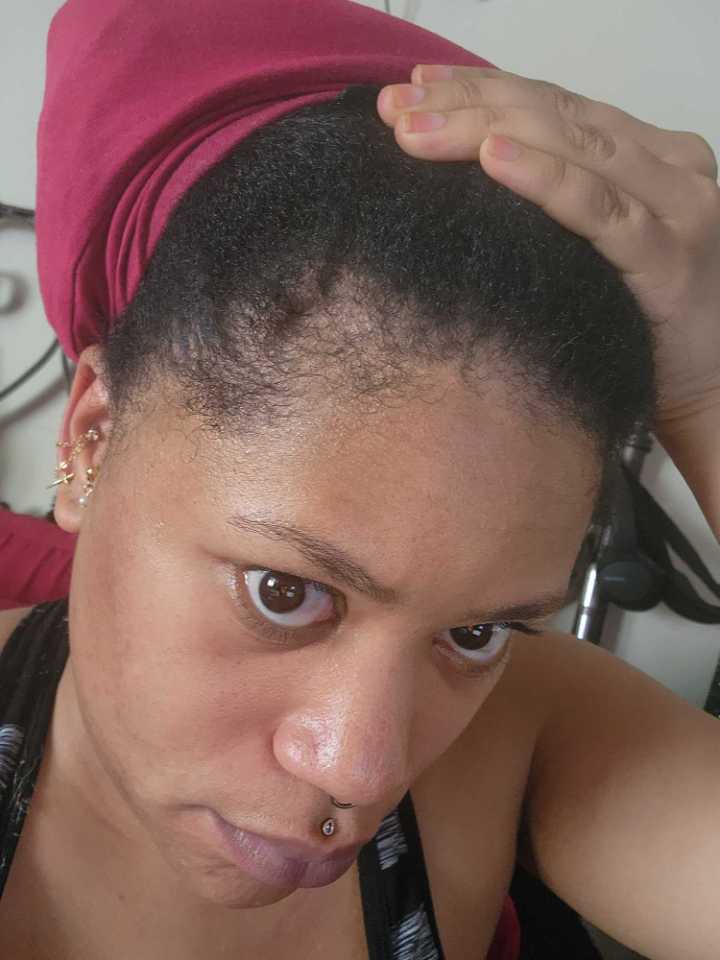 The Hair Topical Solution - Classic review photo by soleen H.