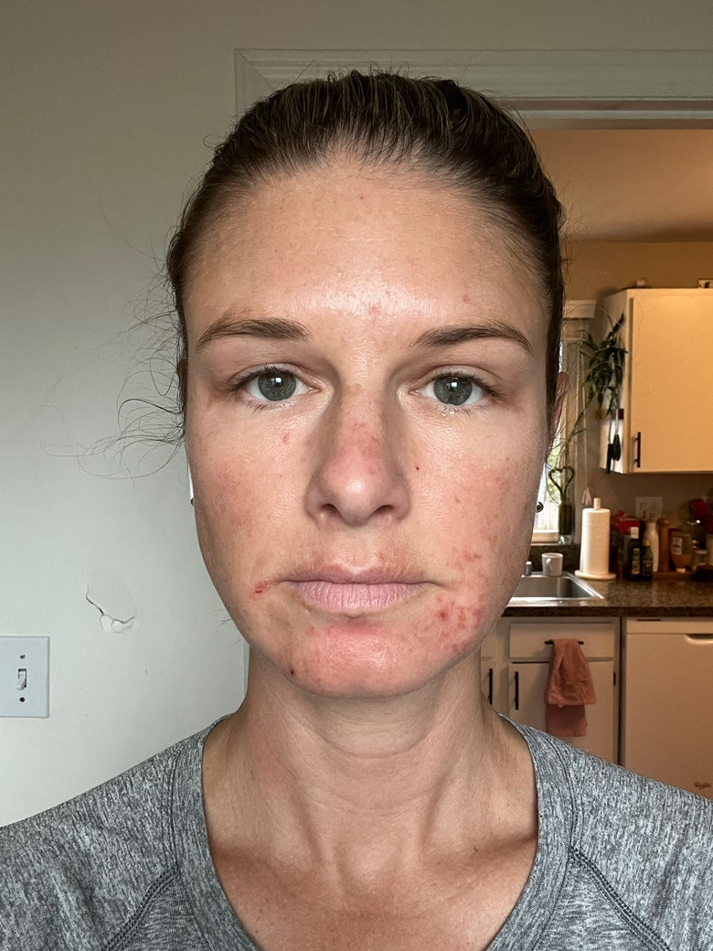 Customer photo