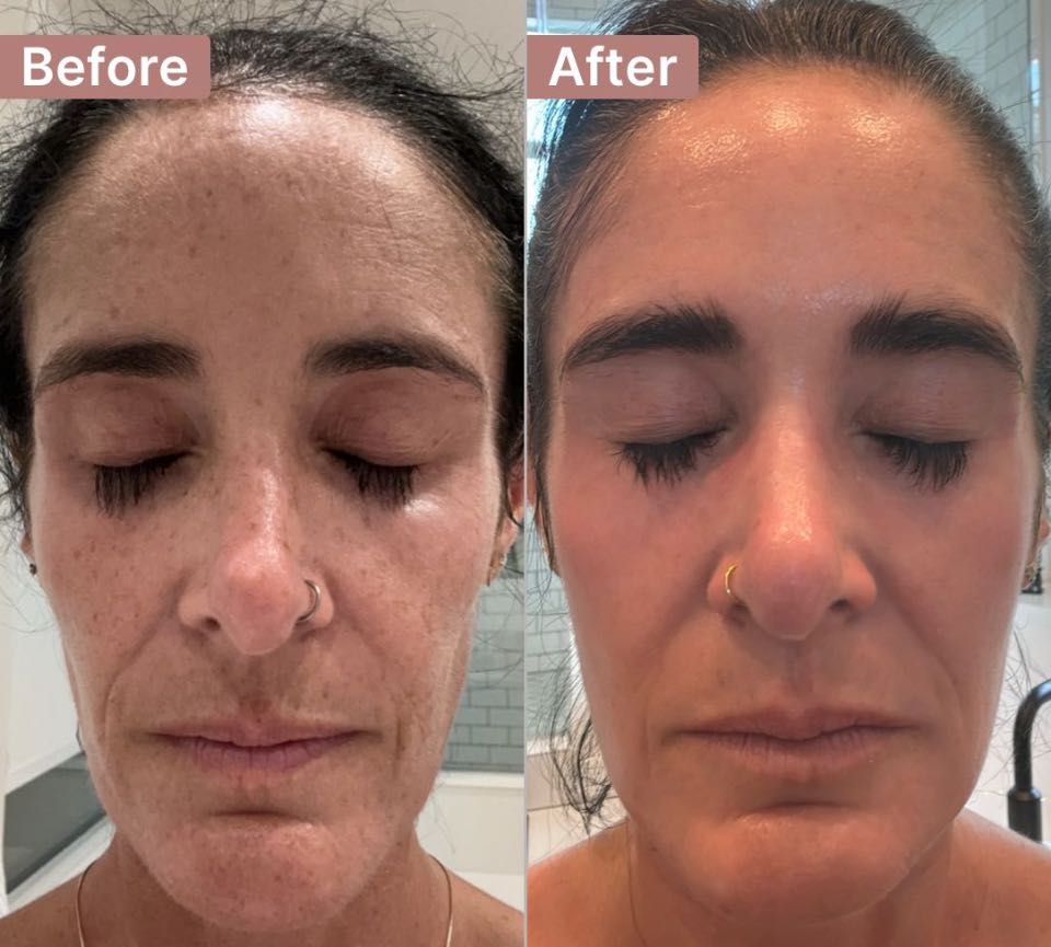 The Aging Repair Cream review photo by Laura S.