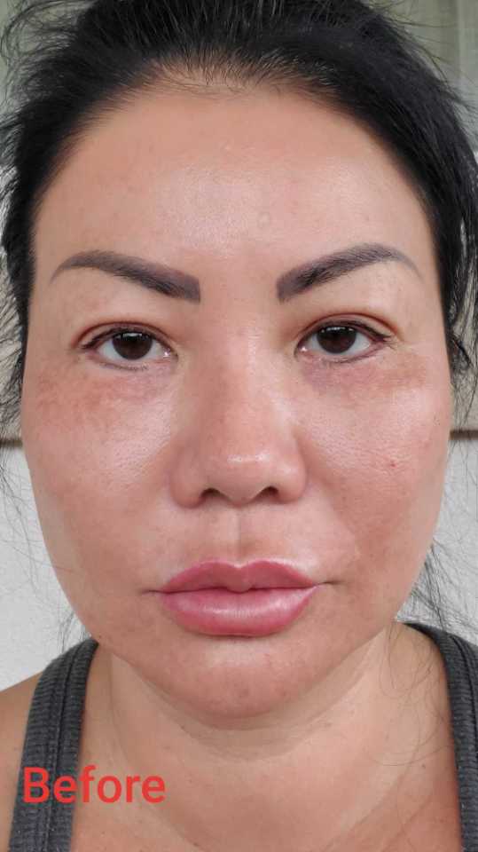 The Spot Cream review photo by musely1009p T.