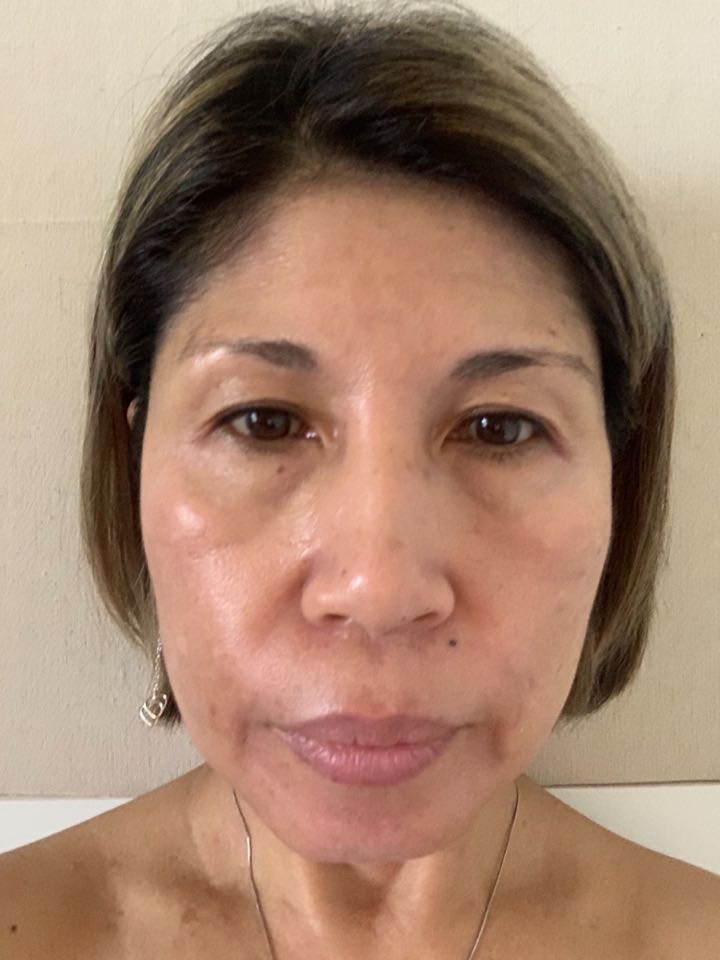The Spot Cream review photo by Dolores A.