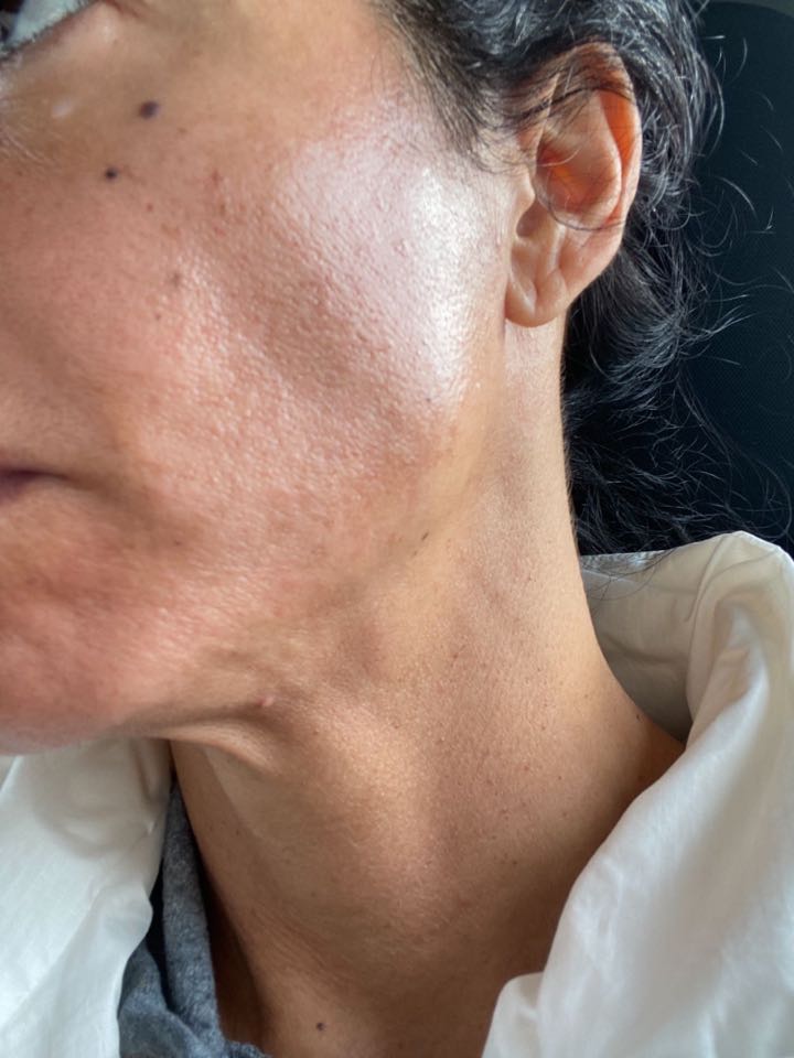 The Spot Cream review photo by julia D.