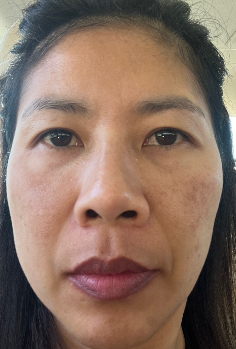 The Spot Cream review photo by Natthacha  B.