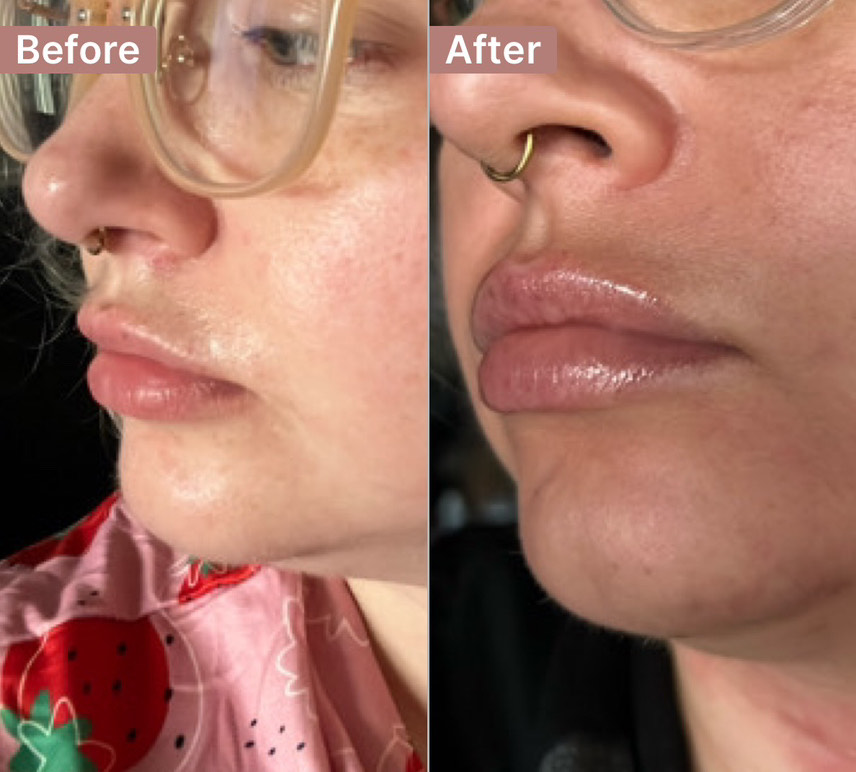Customer photo