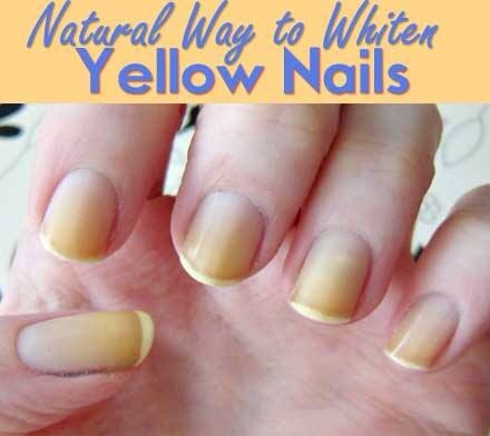 Natural Way To Make Your Skin Whiter Natural Way To Make Your Skin Whiter